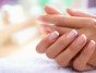 6 способов борьбы с белыми пятнами на ногтях